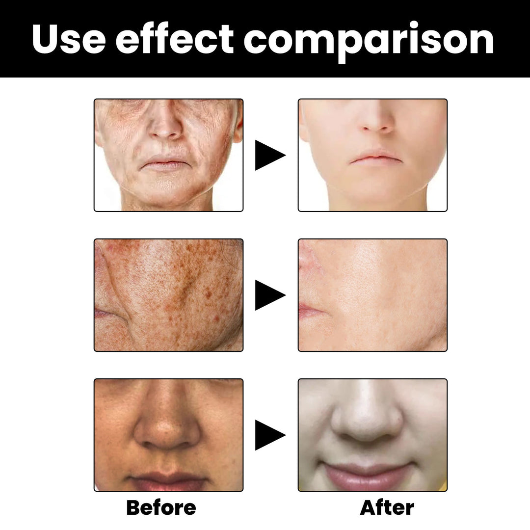 Melanin Repair Hydrating Facial Essence