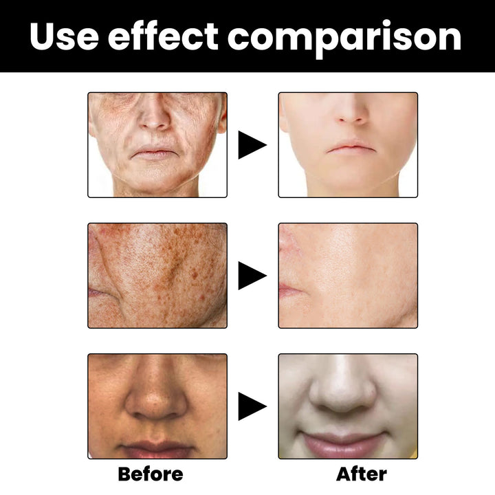 Melanin Repair Hydrating Facial Essence