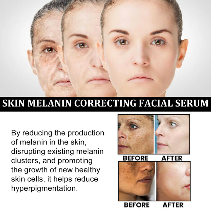 Melanin Repair Hydrating Facial Essence